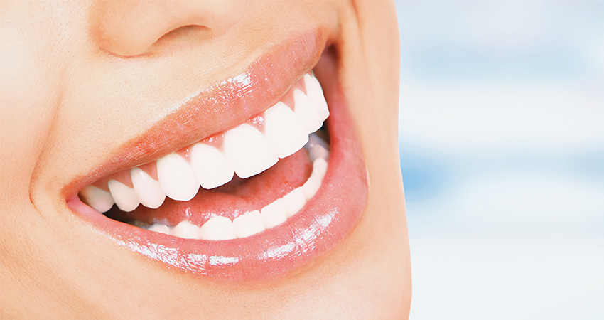 Teeth Whitening Is A Great Way To Achieve A Sparkling Smile   Whitening 1 